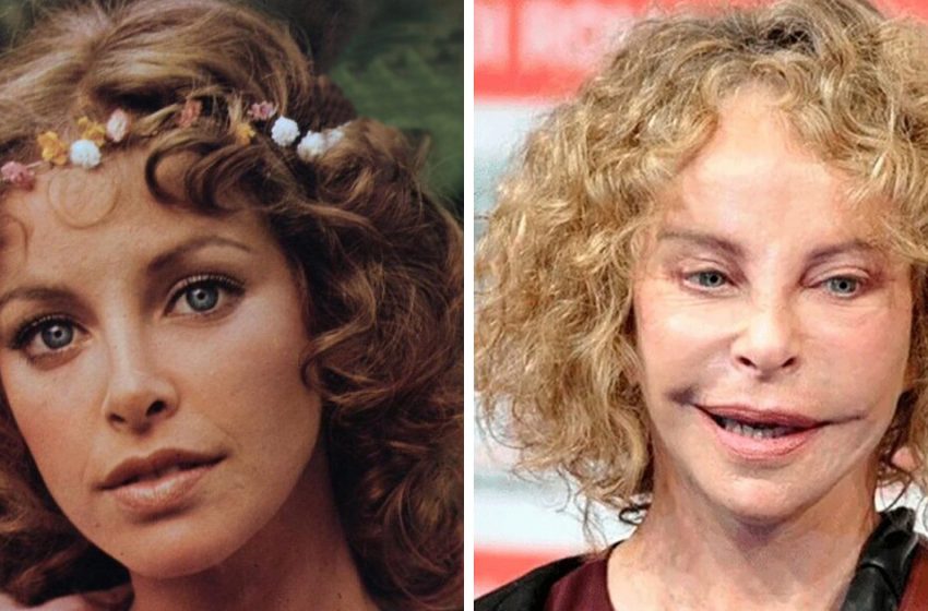  When the surgeon overdid it: 9 stars that are almost impossible to recognize after plastic surgery