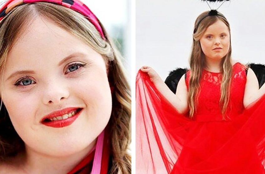  “I want to conquer Hollywood!”: 22-year-old British girl with Down syndrome became a model