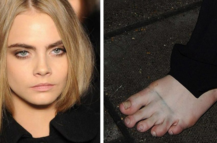  Yellow and uncleaned nails: Hollywood stars’ pedicures up close