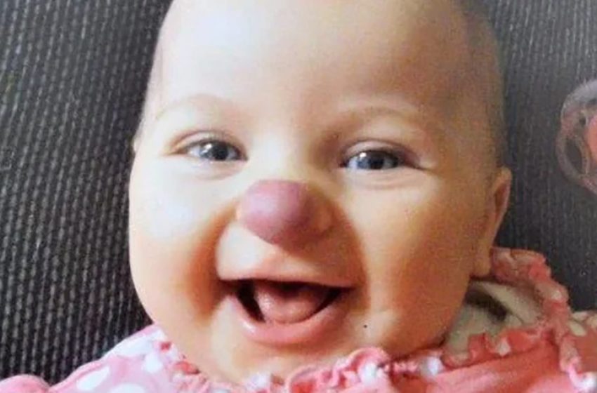  Nine years ago, a young girl was born with a distinctive “clown nose” appearance: Look at her current appearance and lifestyle