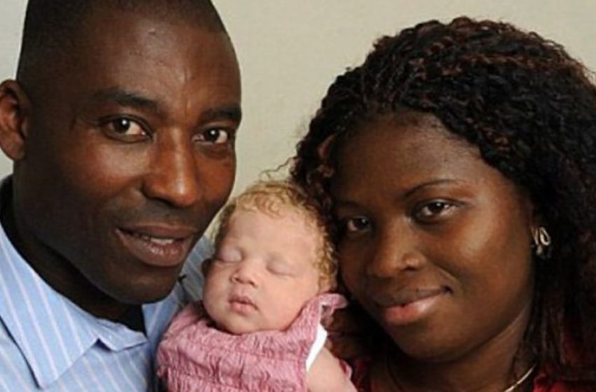  Eleven years ago, a Nigerian couple gave birth to a “white angel.” What a beauty the girl has become years later
