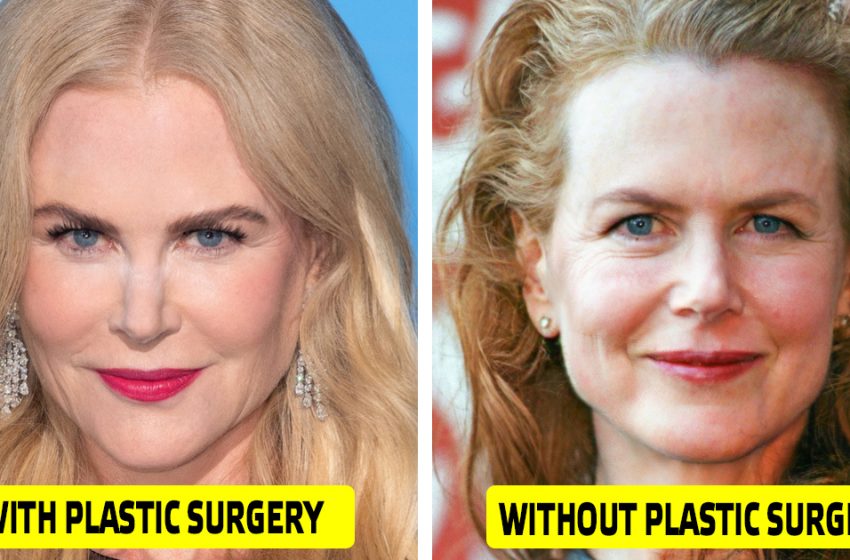  Doctor showed what 10 world stars would look like without any plastic surgery