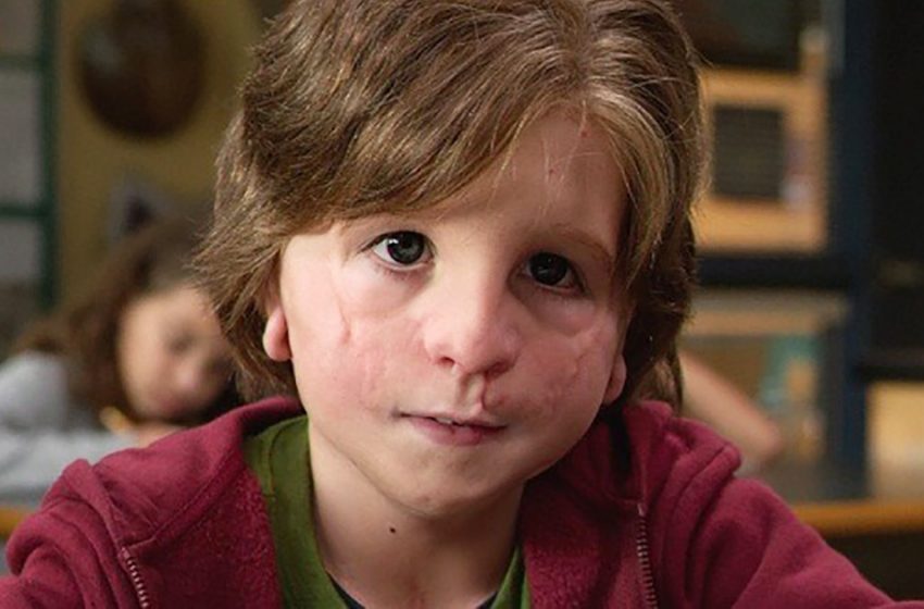  Grew up handsome. How the actor who played the boy Auggie in “Miracle” looks 5 years later