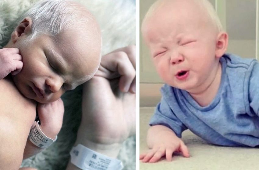  “Such cute boys”: what brothers who were born with gray hair look like now