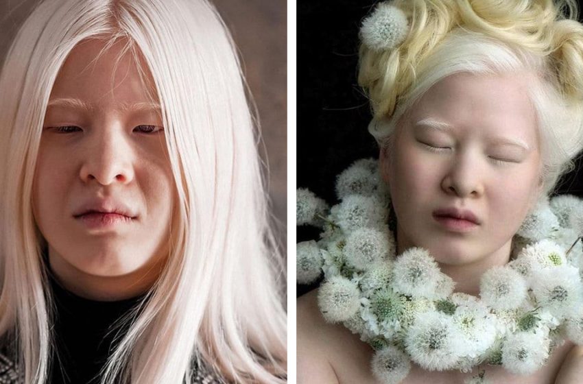  An Infant Dropped off at the Doorstep of an Orphanage. This Chinese Woman with Albinism Grew up to Become a Vogue Model