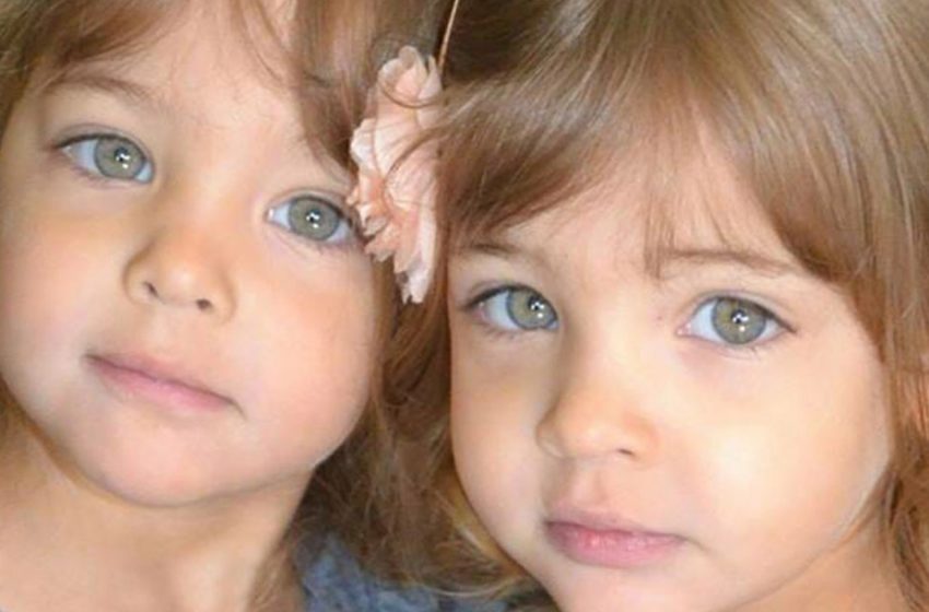  They are now 13. What the world’s prettiest twins look like now