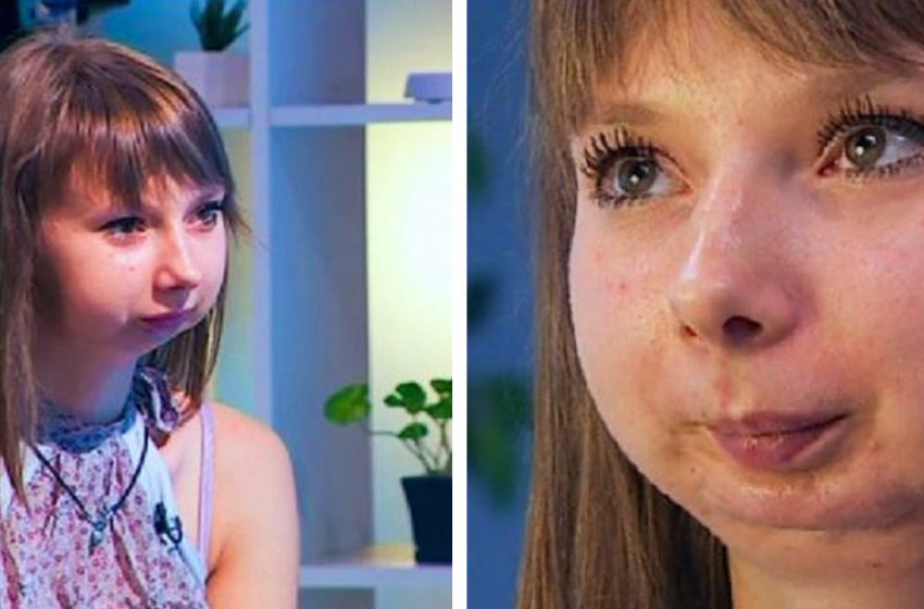  How was the Fate of the Girl whose Doctors were Able to Restore the Lower Part of her Face