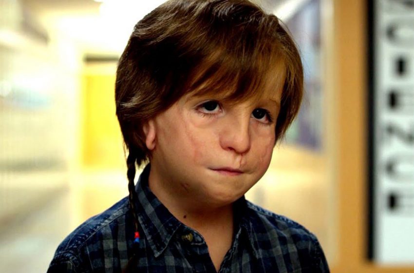  Without Makeup, He’s Unrecognizable: How the Actor who Played Auggie from “Miracle” Looks Now