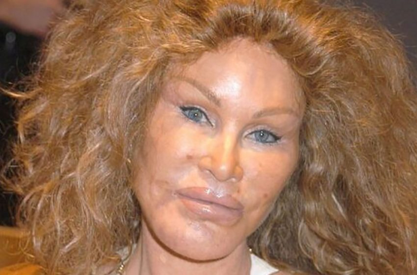  She Made Herself a “Catwoman” and Now She Regrets it. What did 82-year-Old Jocelyn Wildenstein Look Like Before Plastic Surgery?