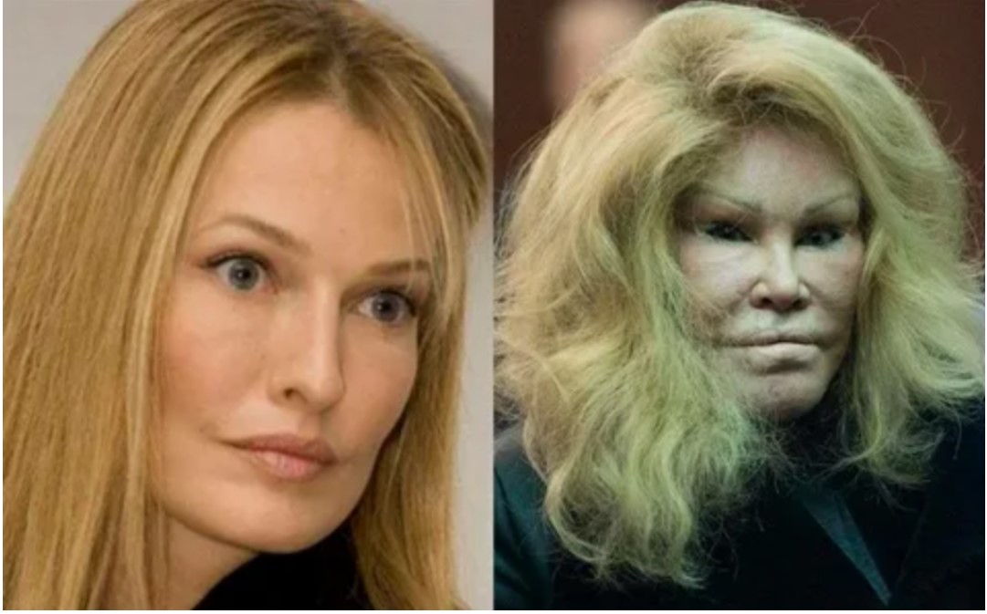 “82YearOld Jocelyn Wildenstein’s Regrettable Transformation” Her