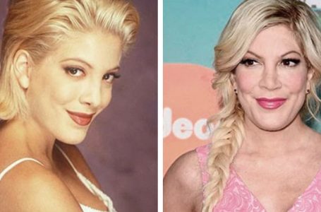 “In a Wheelchair And Bruised”: The Photos Of Tori Spelling Taken By The Paparazzi Scared Her Fans!