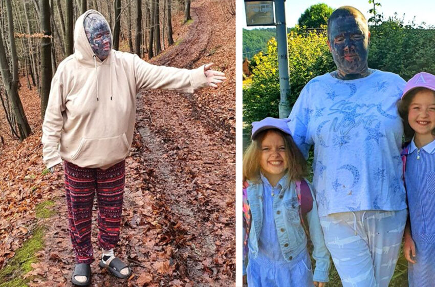  “Unbelievably Weird”: The Woman Is Banned To Enter Her Kids’ School And Cannot Even Find Any Job Because Of Her Appearance!