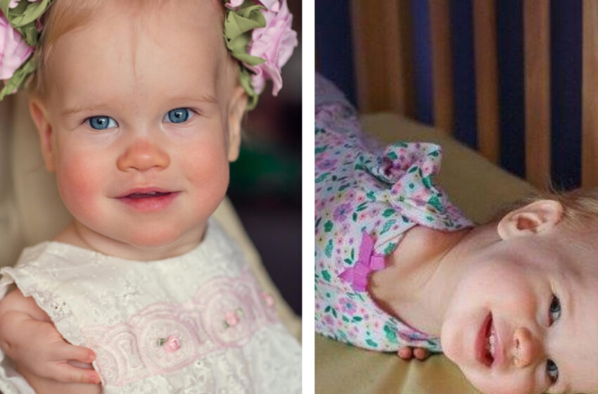  “Girl with Physical Disabilities”: The Foster Family Gave Real Warmth And Love To a Girl Born With Physical Disabilities!