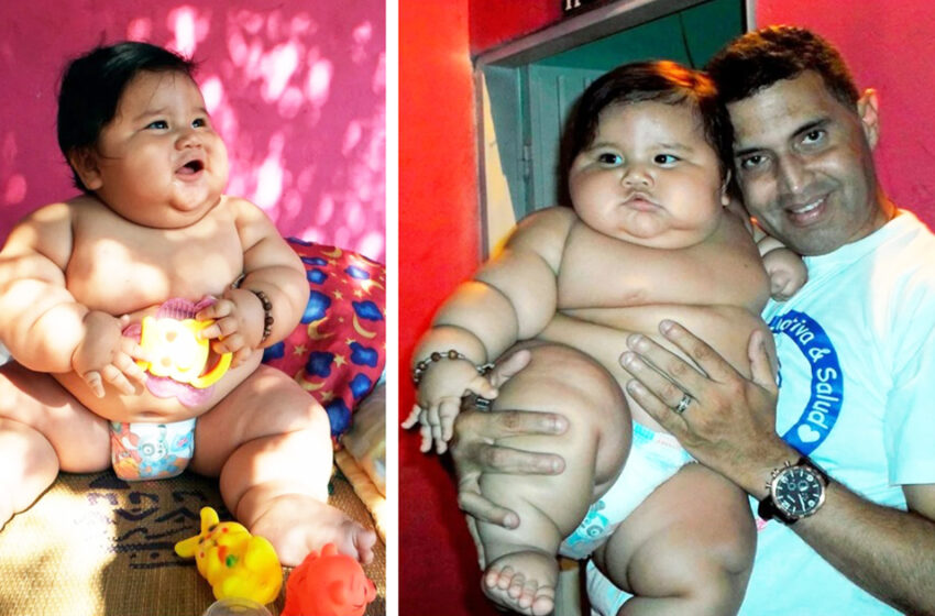  An 8-month-old Baby From Colombia Weighed As Much As 44 lbs: What Does The Boy Look Like Now?