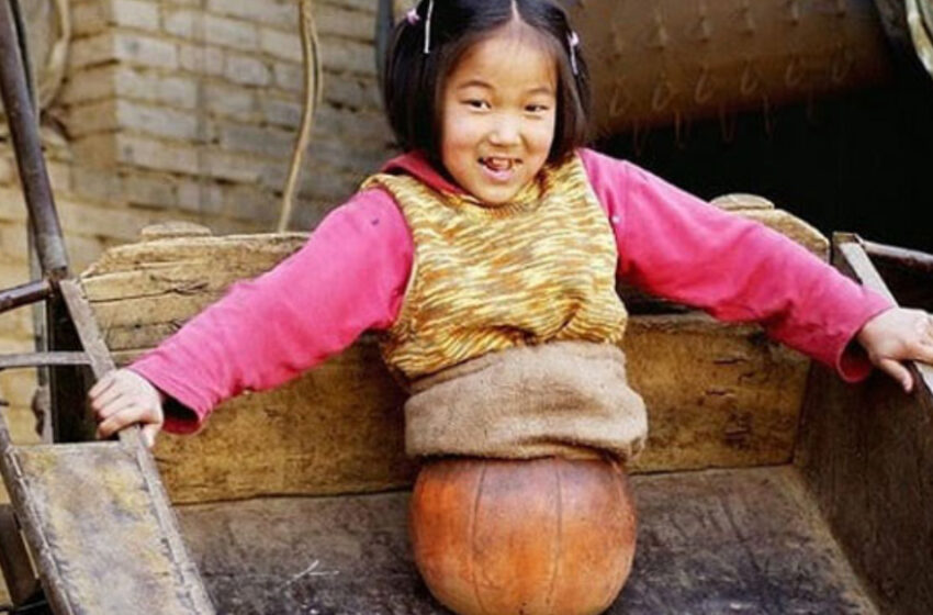  The Girl Lost Her Legs After An Accident: A Basketball Ball Replaced Her Legs And Thanks To Her Perseverance She Became a Champion!