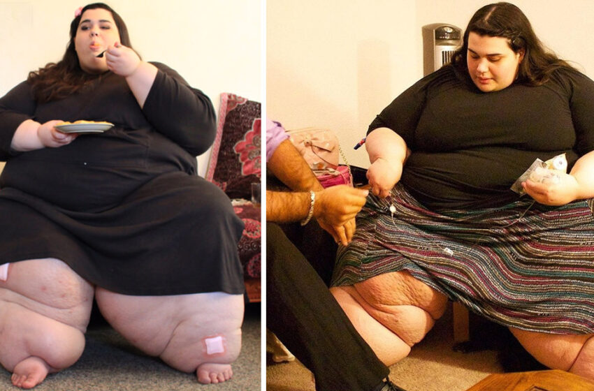  “The Girl Weighed 660 lbs At 28 Years Old”: She Lost 440 lbs And Turned Into A Real Beauty!