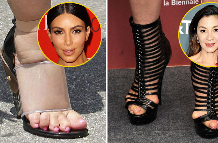 “Not Perfect at All”: Photos Of Celebrity Feet That Are Far From Being Ideal!