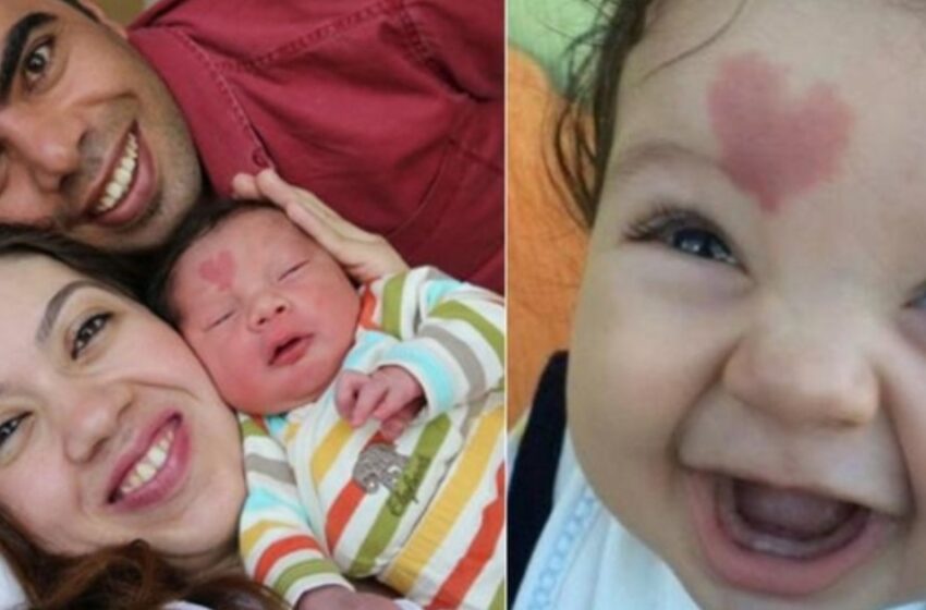  A Baby Born With A Heart-Shaped Birthmark On His Forehead: What Does He Look Like Now?