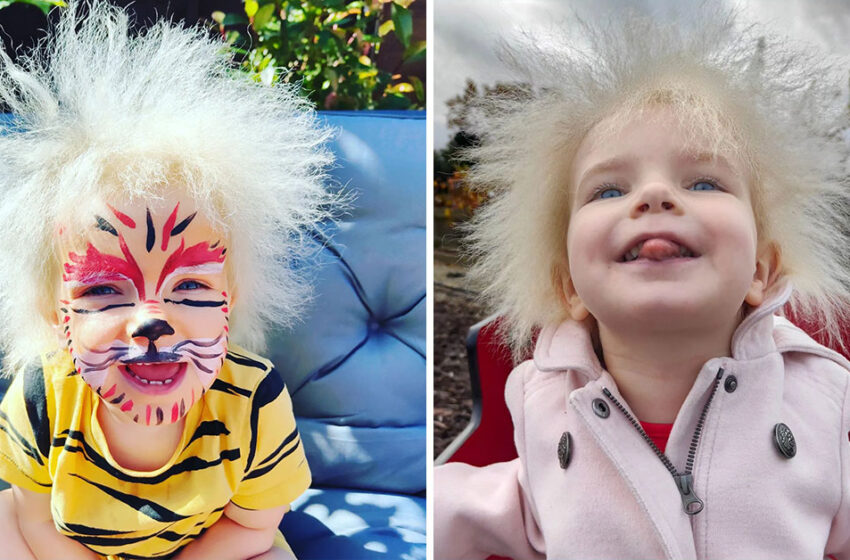  The Girl’s Cute Photos Spread All Over The Net: What Does a Little British Girl With Uncombable Hair Syndrome Look Like?
