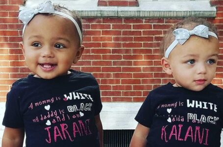 The Birth Of Twins With Different Skin Colours Shocked Parents: What Do The Children Look Like Now – At 7 Years Old?