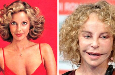 “They Crossed Out Their Future”: Stars Who Couldn’t Correct The Consequences Of Plastic Surgery!