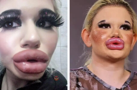 “She Was Such a Nice Girl”: What Does The Girl Who Underwent Over 20 Plastic Surgeries Look Like Before All The Cosmetic Interventions?