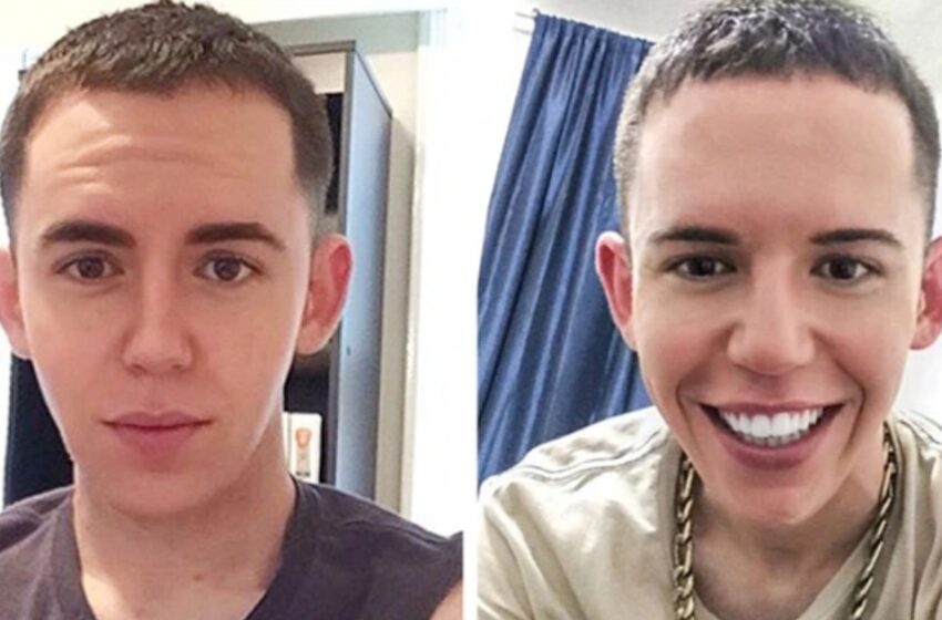  “The Resemblance Is Really Striking”: The Guy Spent Over $100.000 On Plastics To Look Like Britney Spears!