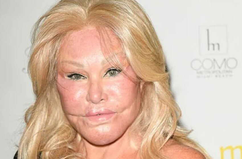  The 84-Year-Old Plastic Surgery-Obsessed “Catwoman” Has a New Face And Body: What Does She Look Like Now?