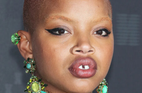 “As a Child She Was Offended And Disliked”: Now The Young Model, Slick Woods Dictates New Trends!