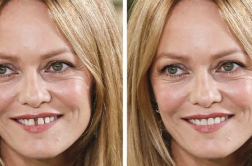  What Would Celebrities Look Like if They Didn’t Have Their Special Features: 10 Stars With And Without Their “Imperfections”!