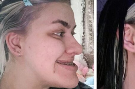 12 People Who Resorted To Plastic And Couldn’t Get Enough Of The Result: Amazing Before/After Photos!