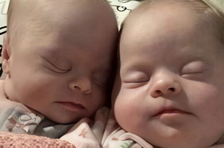Dvynukų su Dauno sindromu mama nustelbė kritikų stipriu atsakymu: ką ji pasakė?