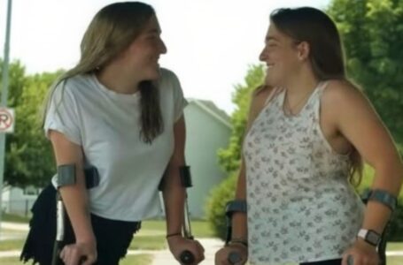 Buvusios suaugusios dvynės dabar – klestinčios paauglės, gyvenančios įprastą gyvenimą! 10 metų po jų gyvenimą pakeitusios operacijos!