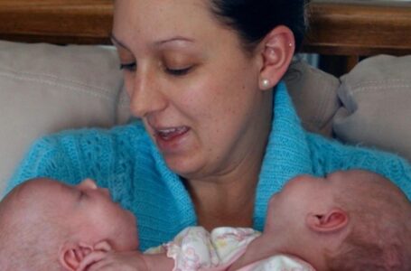 „Joms Buvo Atliekama Operacija Vos Sulaukus 6 Mėnesių“: Jaudinanti Suaugusių Dvynių Istorija, Kurios Dabar Gyvena Puikiai Kartu!