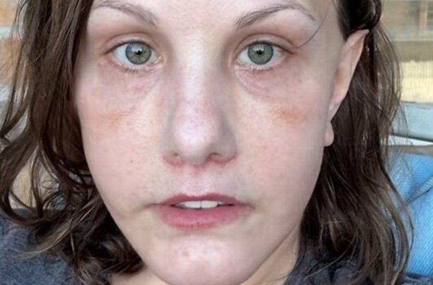  “Neatpazīstama pēc 15 000 dolāru vērtas sejas liftinga”: meitenes pārvērtības ir sagādājušas haosu internetā!