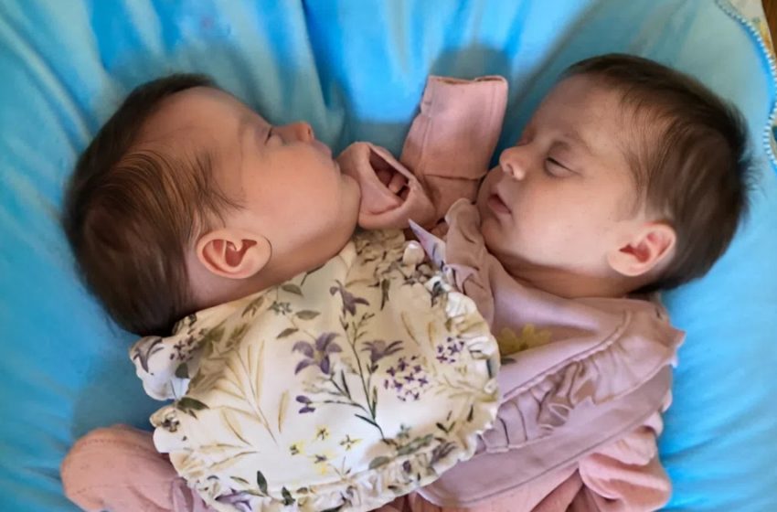  No saaugušiem pie krūtīm līdz plaukstošiem bērniem: šķirti dvīņi 3 gadus vēlāk — skatiet viņu fotoattēlus