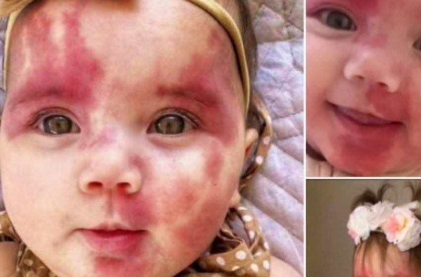  Mazulīte vārdā “Briesmīga” un “Defektīga” pārsteidz visus ar savu neticamo pārvērtību!: Apskatiet fotoattēlus!